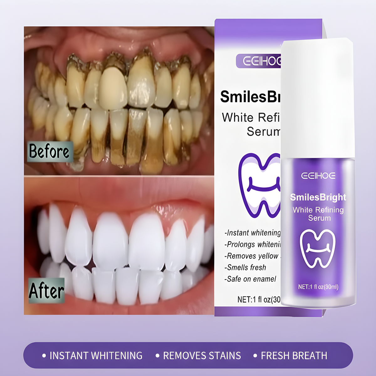 Radiant Smile Whitening Gel