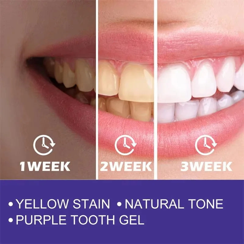Radiant Smile Whitening Gel
